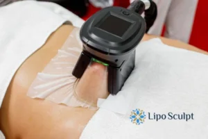 Cryolipolysis Helping You Getting that Perfect Summer Body 3 Cryolipolysis Earley can give you the best summer body - contact us today!